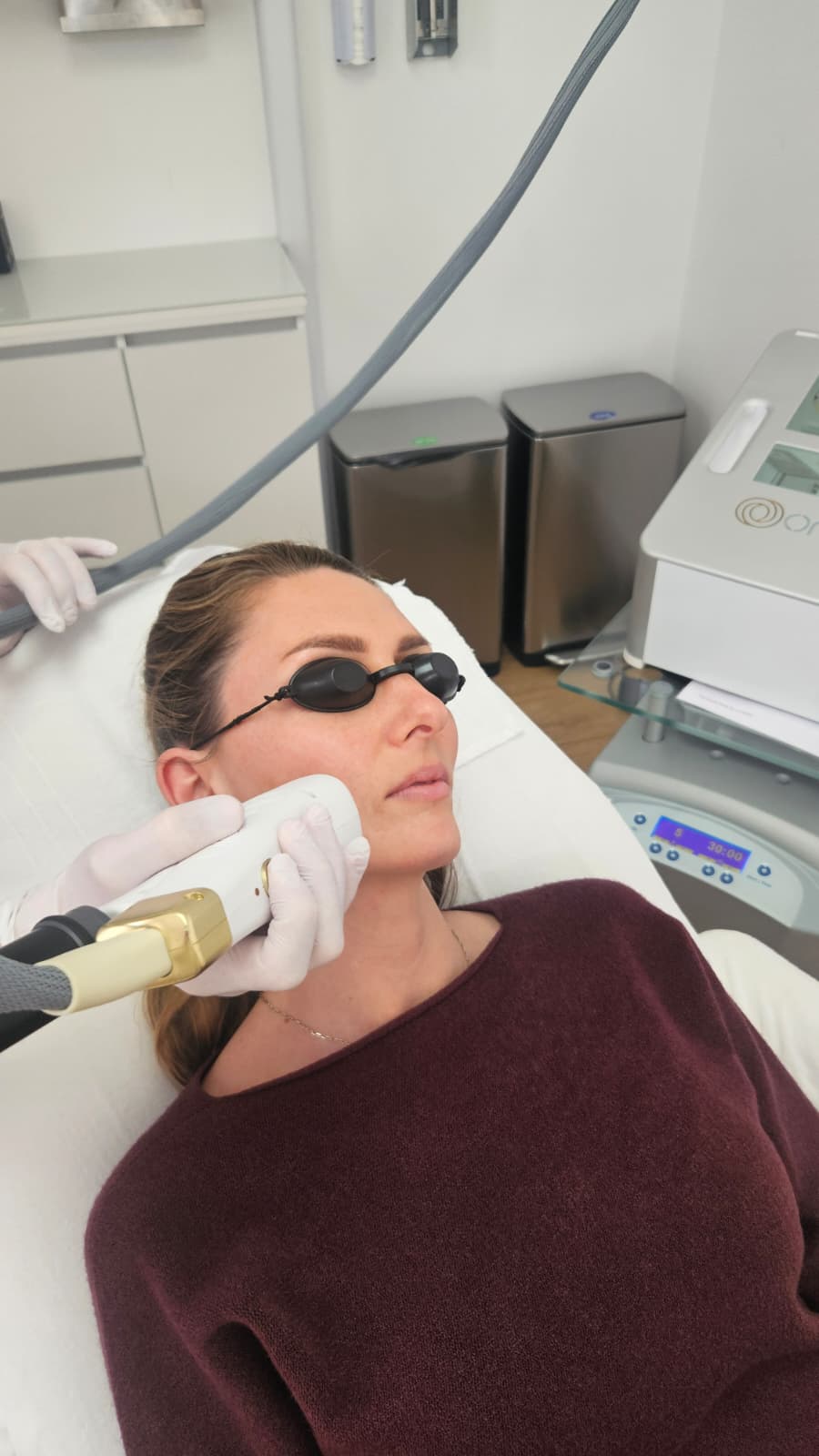 Erbium Glass Laser — behandeling bij Clinic 28